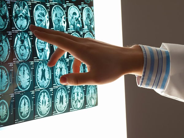brain injury attorney